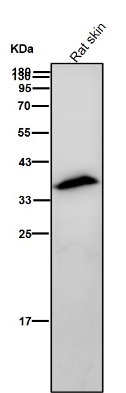 Rabbit Monoclonal to AMPK beta 1