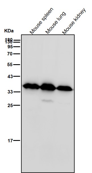 Rabbit Monoclonal to AMPK beta 1