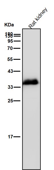 Rabbit Monoclonal to AMPK beta 1