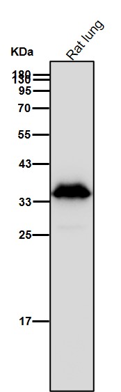 Rabbit Monoclonal to AMPK beta 1