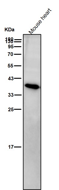 Rabbit Monoclonal to AMPK beta 1