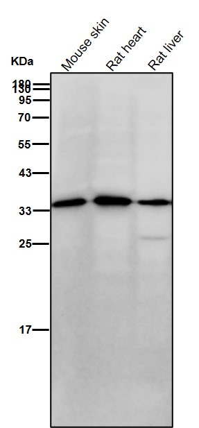 Rabbit Monoclonal to AMPK beta 1