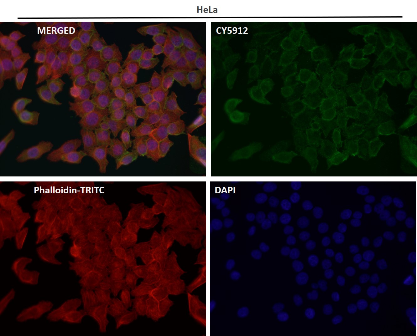 Rabbit Monoclonal to Collagen VI