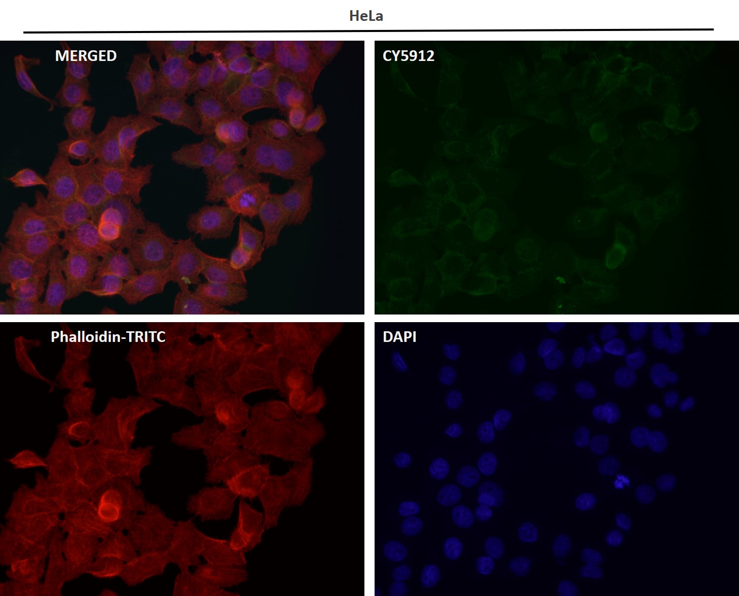 Rabbit Monoclonal to Collagen VI