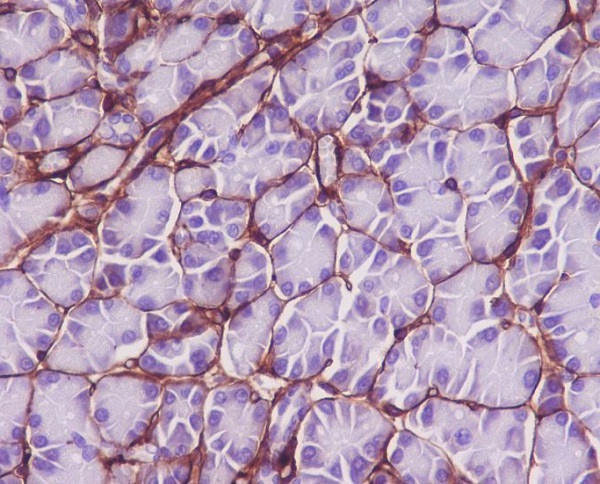 Rabbit Monoclonal to Collagen VI