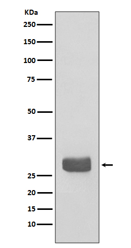 14-3-3 epsilon