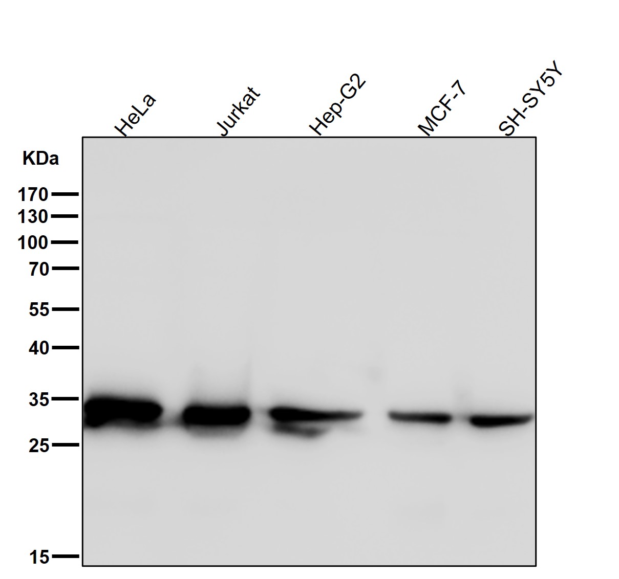 Rabbit Monoclonal to 14-3-3 epsilon