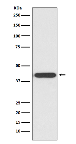 Rabbit Monoclonal to HDAC8