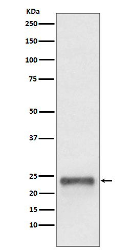 Rabbit Monoclonal to UbiquitinD
