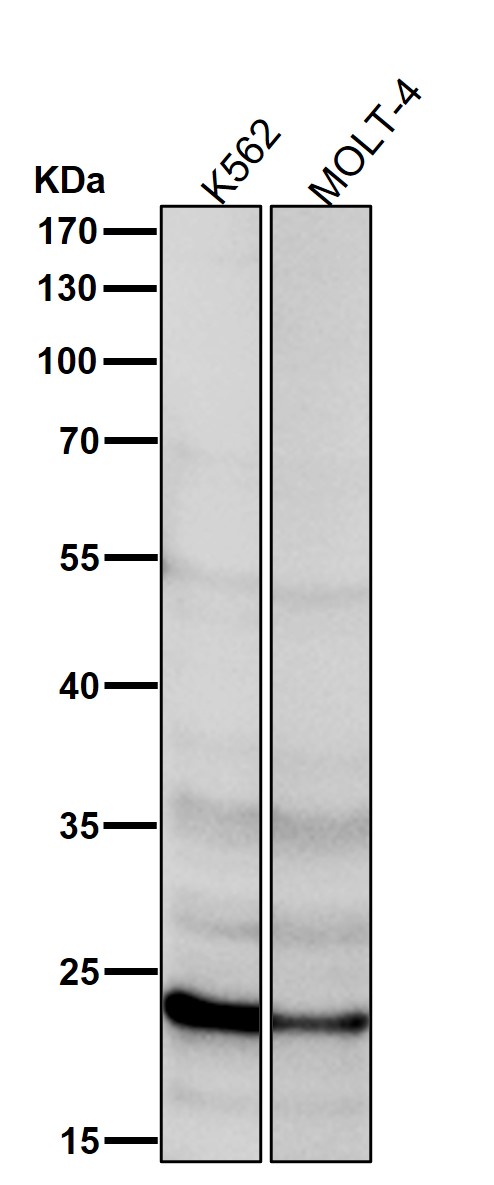 Rabbit Monoclonal to UbiquitinD
