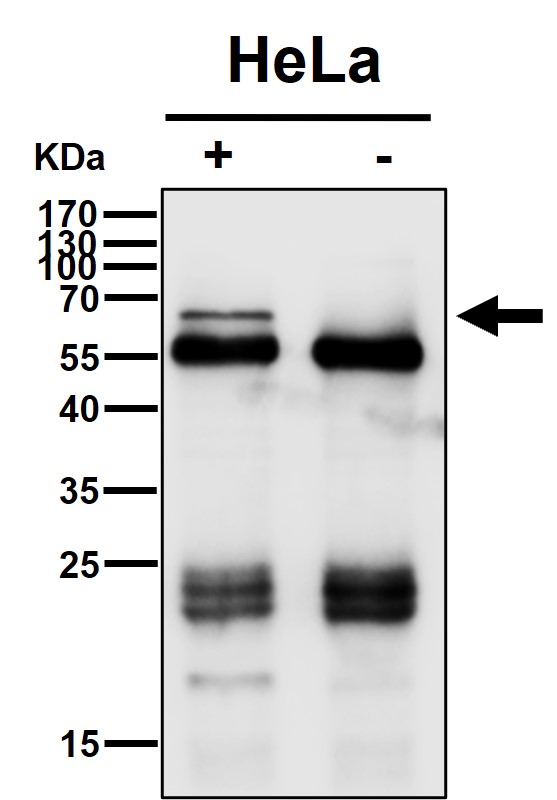 Rabbit Monoclonal to Cdc25B