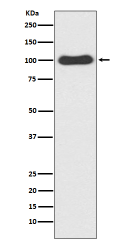 CDC5