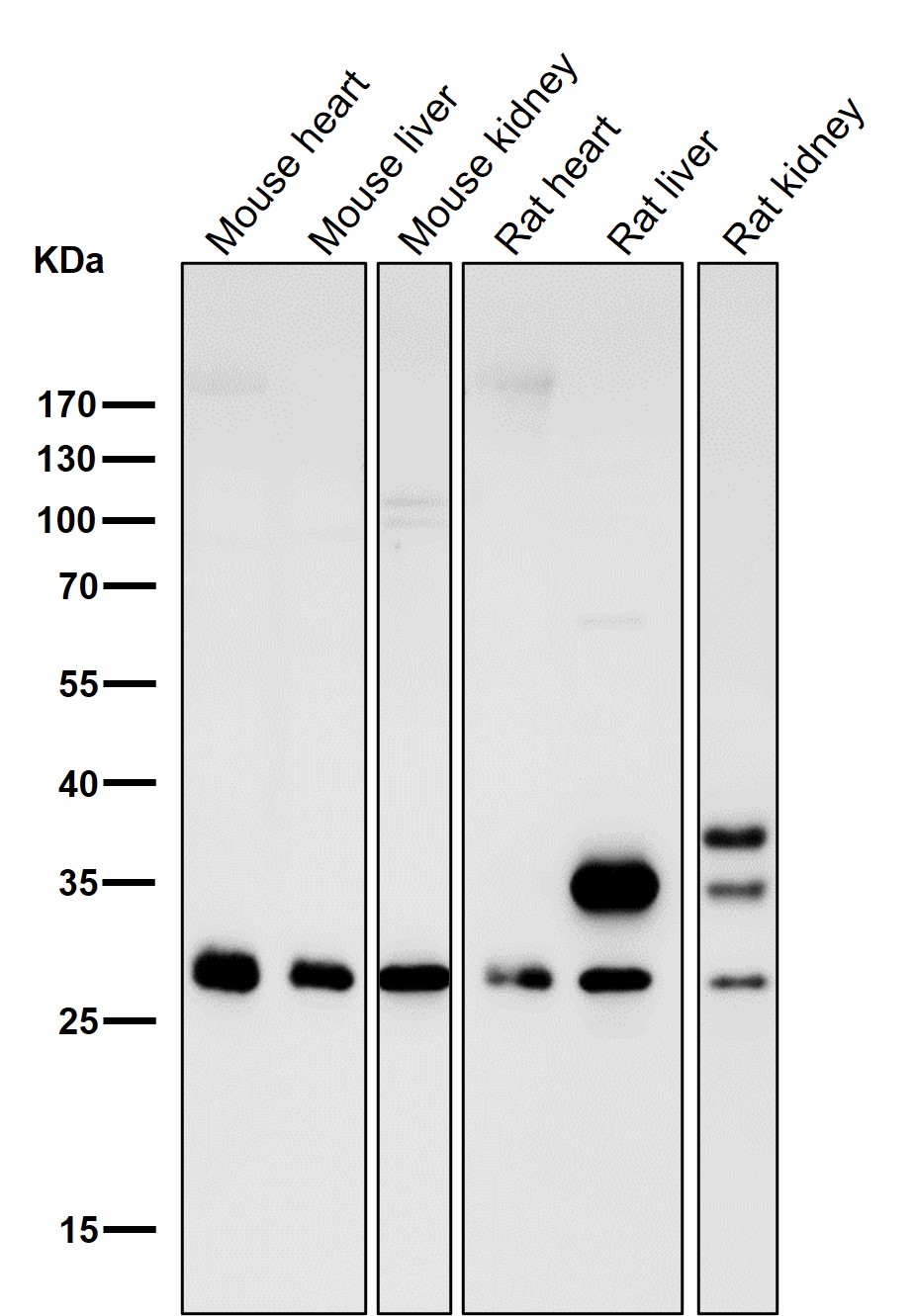 CDCA3