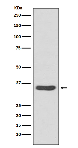 CDCA5