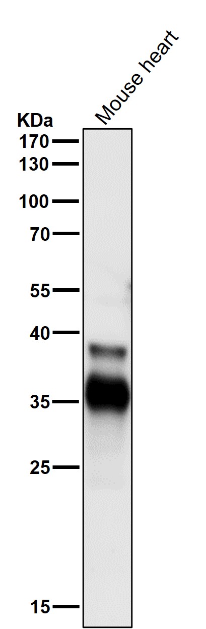 Cdc34