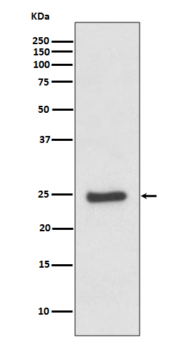Rabbit Monoclonal to ZNRF2