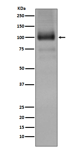 Rabbit Monoclonal to mGluR1