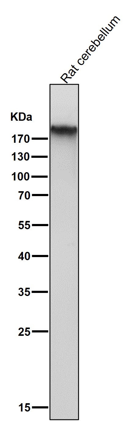Rabbit Monoclonal to mGluR1