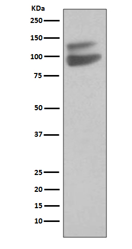 VECadherin