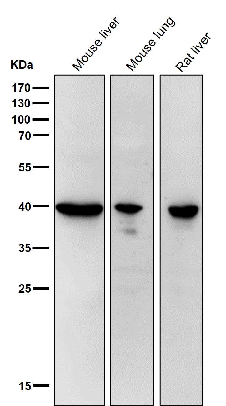 67k DaLaminin Receptor
