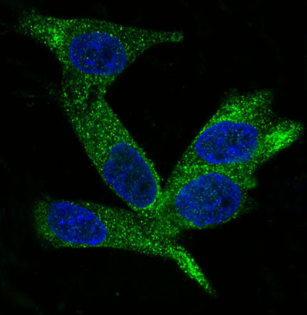 Rabbit Monoclonal to HE4