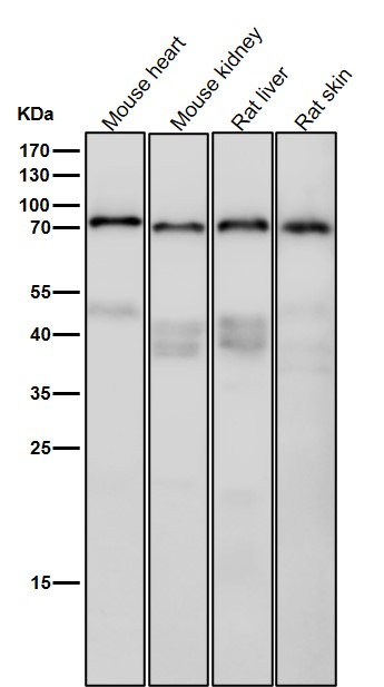 Rabbit Monoclonal to Phospho-PKC alpha(T638)
