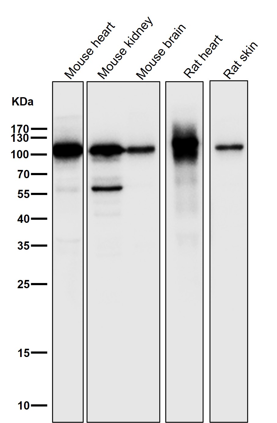 Rabbit Monoclonal to PGC1alpha/beta