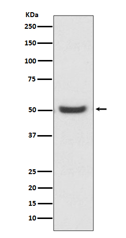 PDIA6