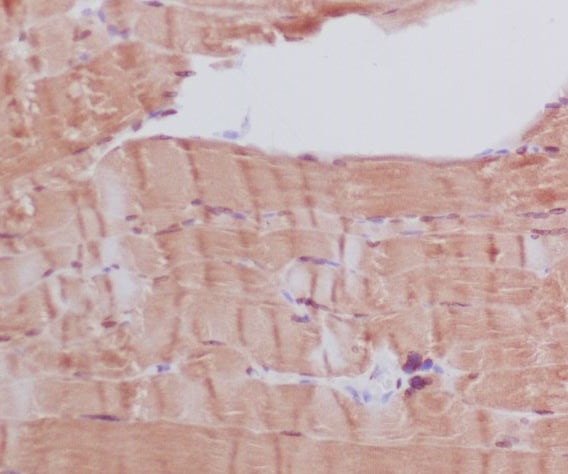 Rabbit Monoclonal to Myosin heavy chain