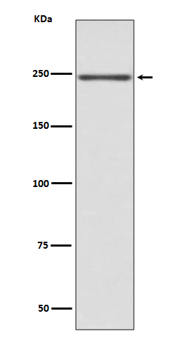 Myosin heavy chain