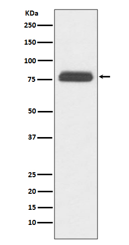 TBR1
