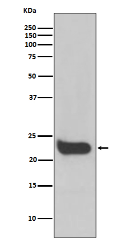 Interferon beta