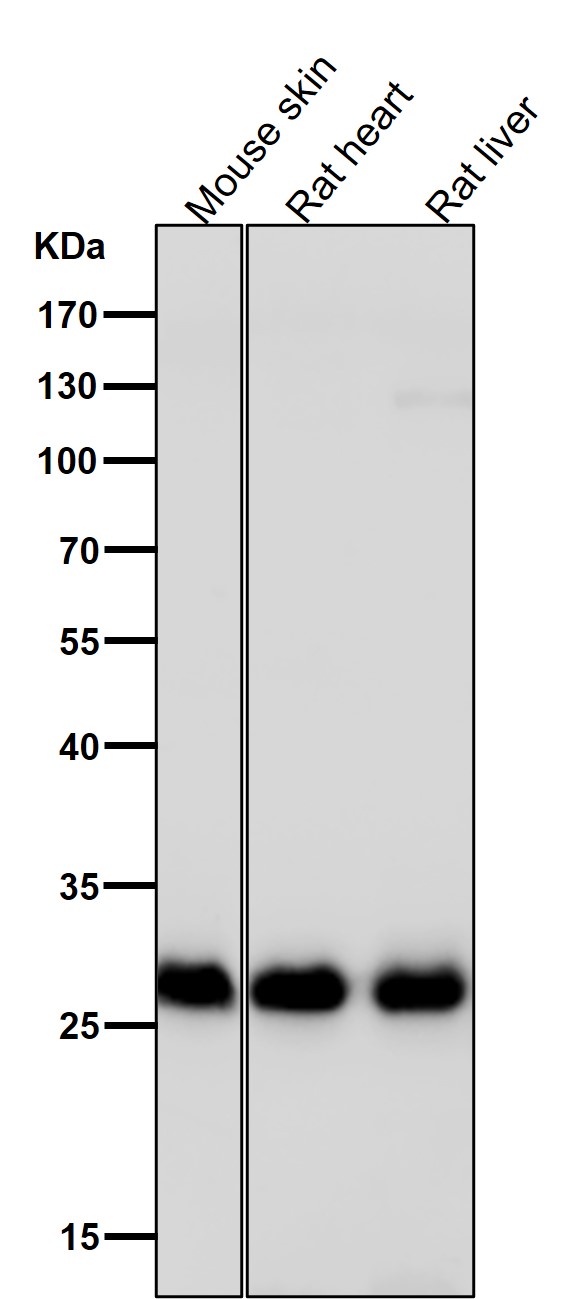 Galectin3