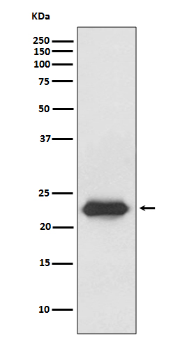 Lipocalin-2