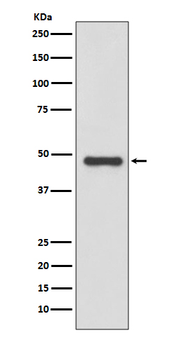 Urokinase