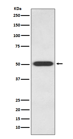 Endothelin B Receptor