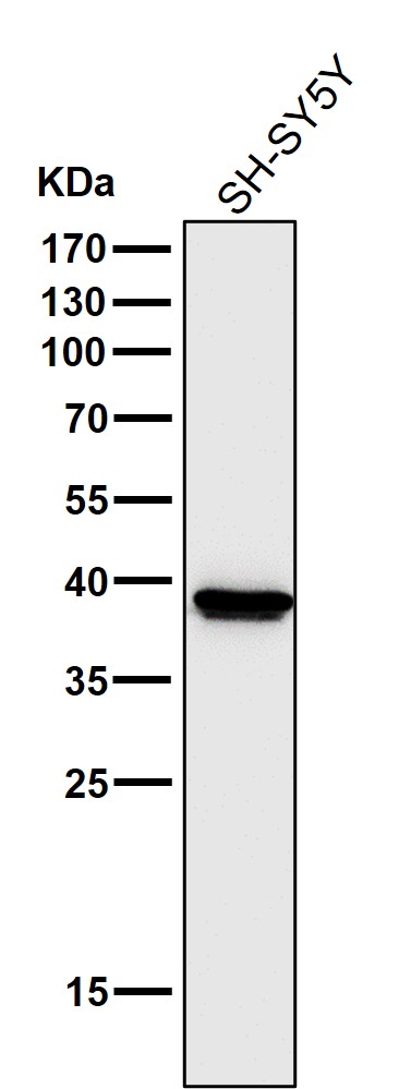 Cathepsin L/V/K/H