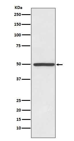 Dopamine Transporter