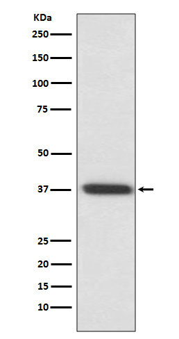 Rhodopsin