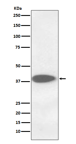 Cathepsin B