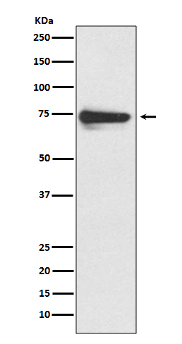 Tyrosinase