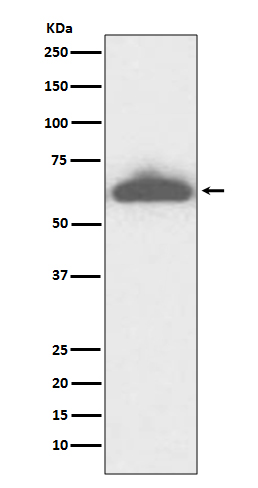 RPE65