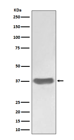 Rabbit Monoclonal to SFRP1