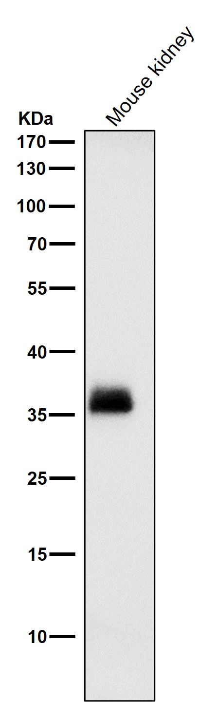 SFRP1