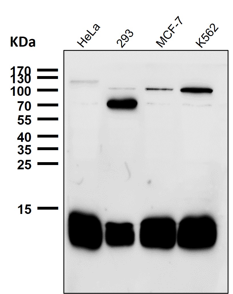 Profilin 1