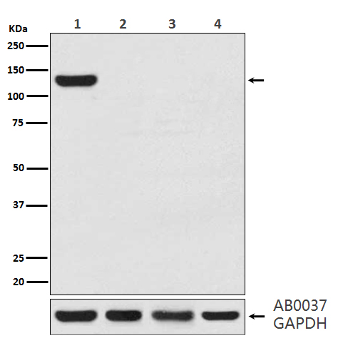 CRISPR Cas9 SA