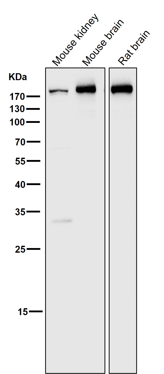 Clathrin heavy chain