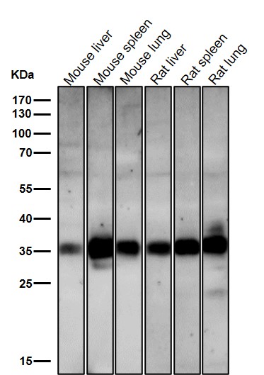 hnRNP A1