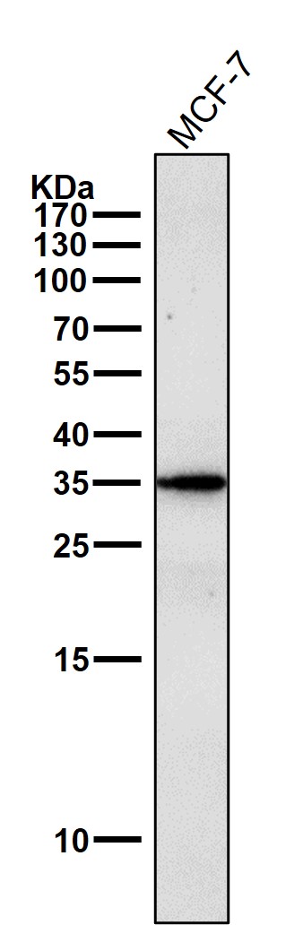 gamma Sarcoglycan