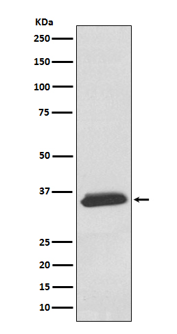 delta Sarcoglycan